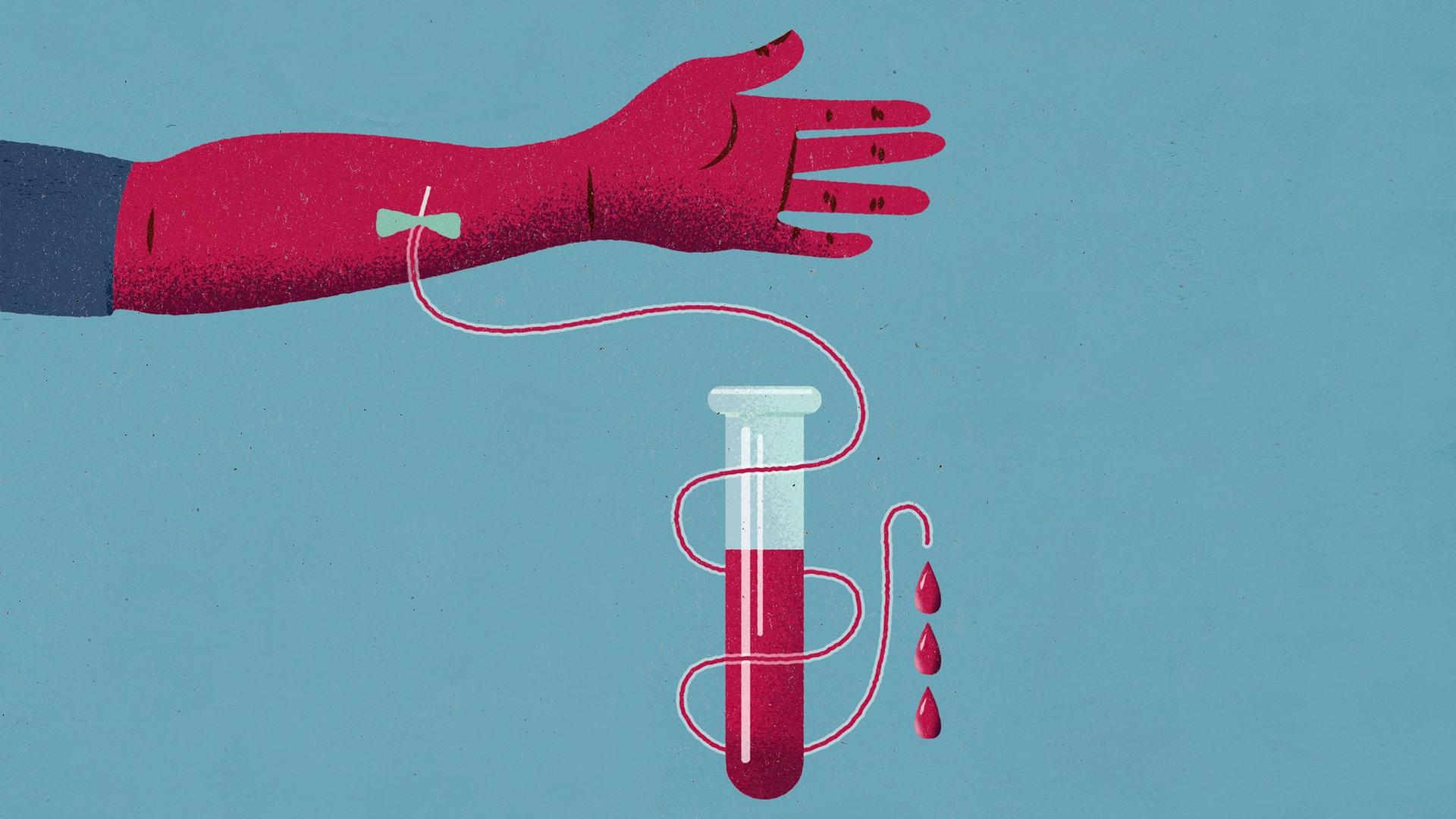 Illustration: Ein ausgestreckter roter menschlicher Arm mit einer Blutkonserve an der Nadel.